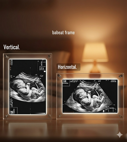 BaBeat Ultrasound Digital Frame 3.0 (6.5-inch)