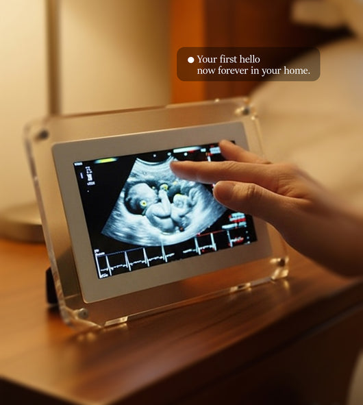 BaBeat Ultrasound Digital Frame 3.0 (6.5-inch)