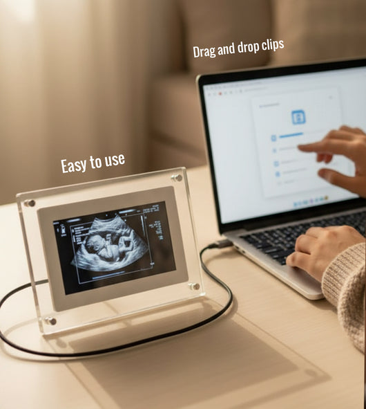 BaBeat Ultrasound Digital Frame 3.0 (6.5-inch)