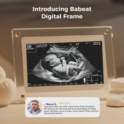 BaBeat Ultrasound Digital Frame 3.0 (6.5-inch)