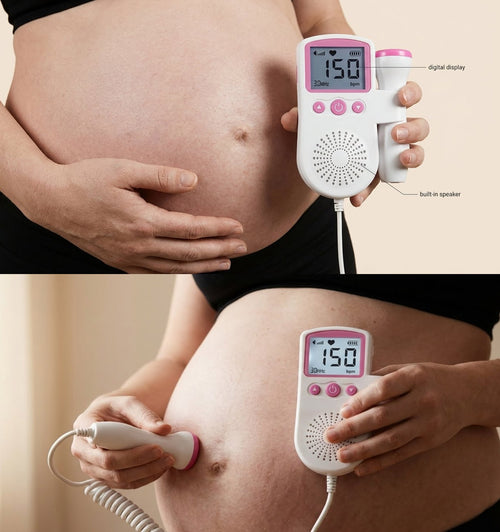 BaBeat™ Fetal Heartbeat Monitor Pro 3.0